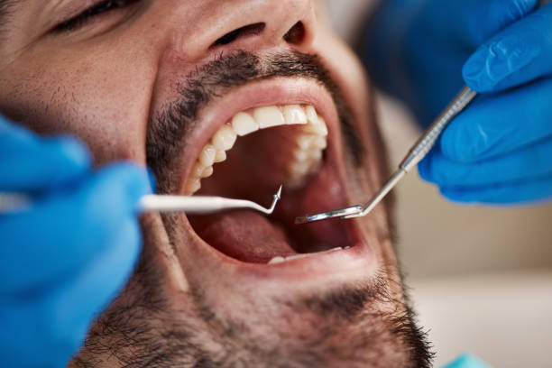 Best Tooth Pain Emergency Relief  in Rio Bravo, TX